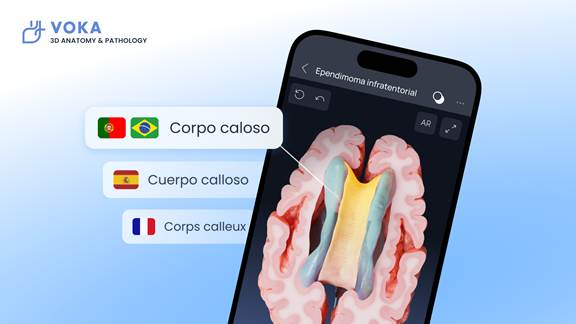 VOKA 3D Anatomy & Pathology Expands Language Support to French, Spanish, and Portuguese